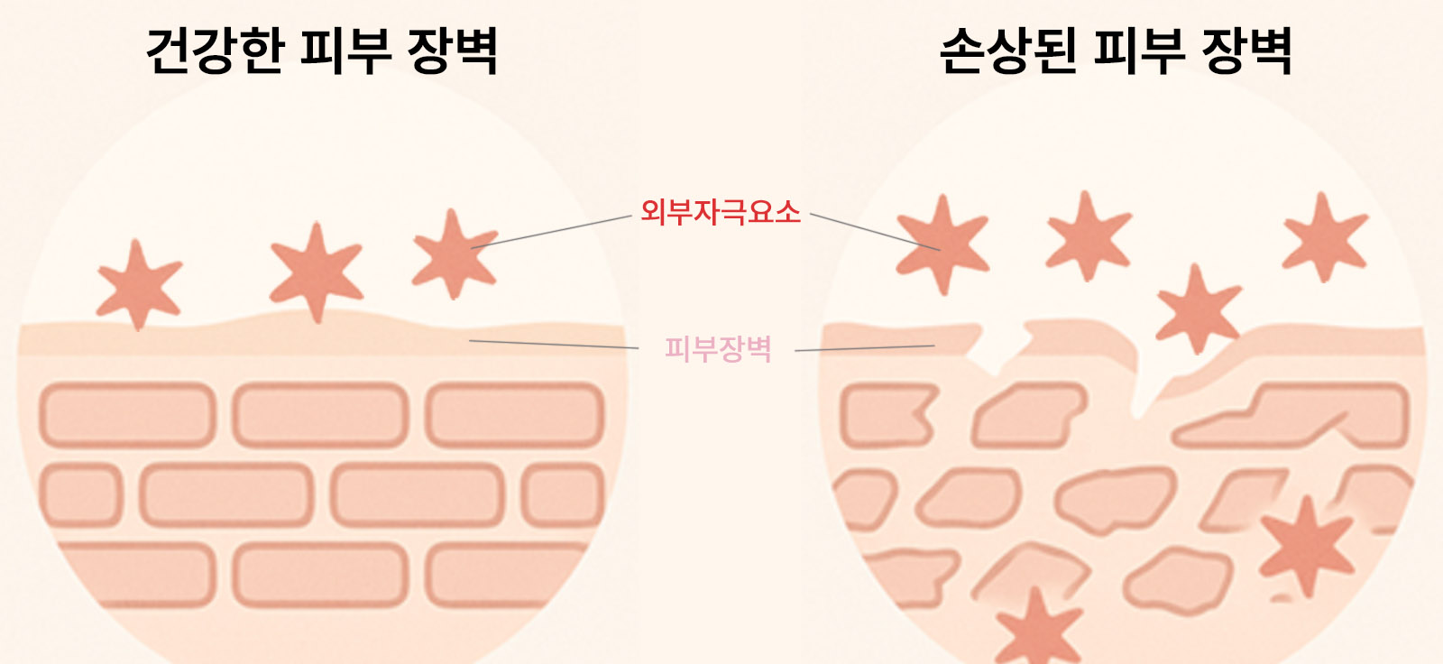 건강한 피부 장벽과 손상된 피부 장벽의 구조적 차이를 보여주는 179에스테틱 비교 이미지