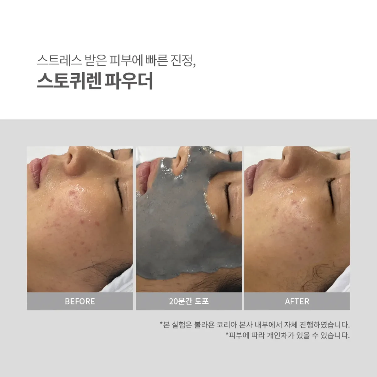 빠른 진정 설명