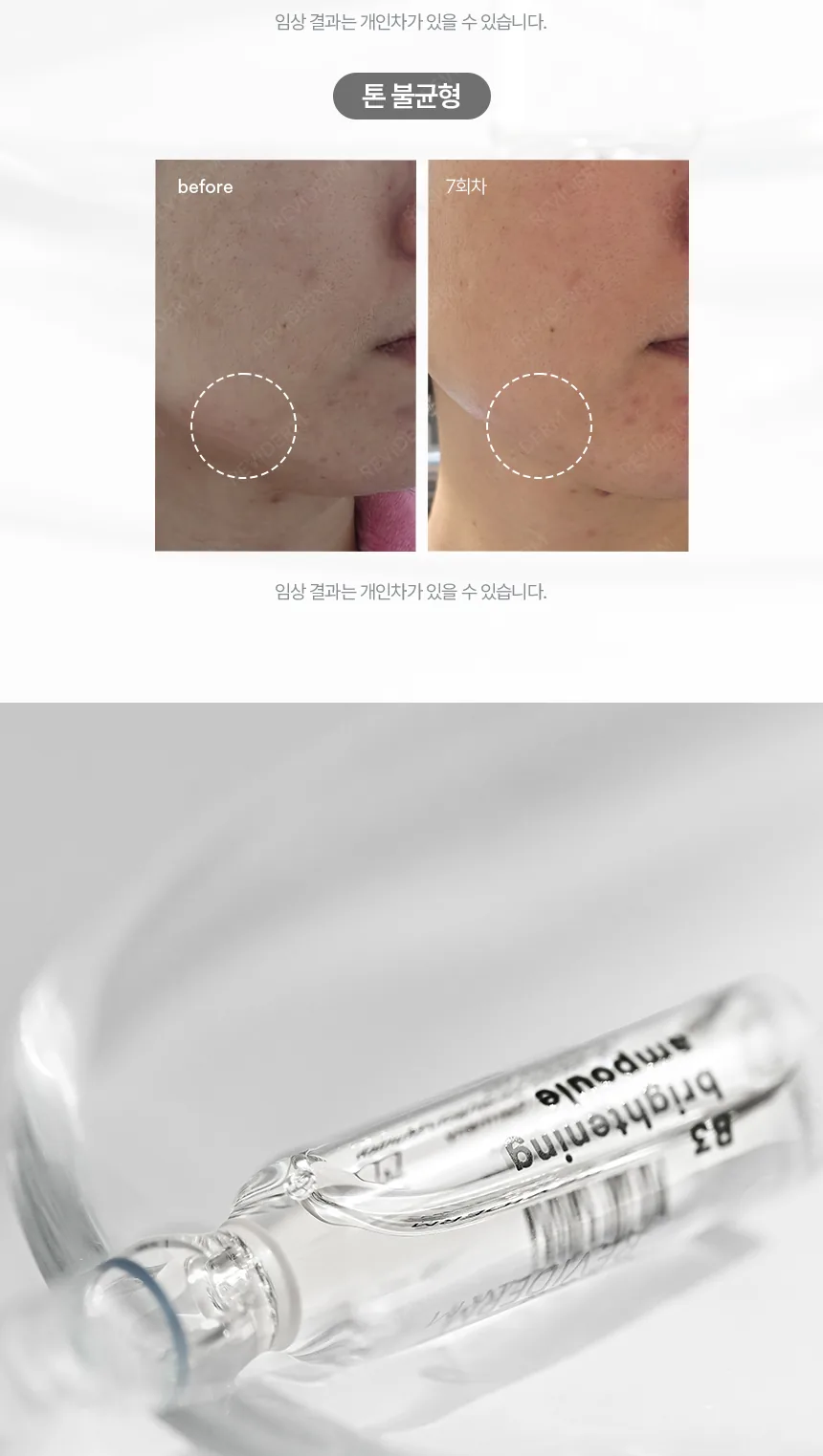 레비덤 B3 브라이트닝 앰플 톤 균형 케어 이미지