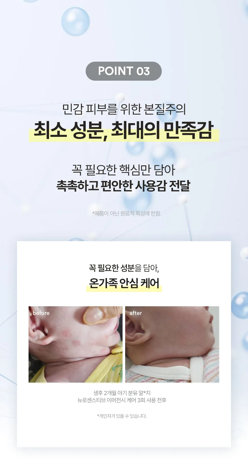 뉴로센스티브 이머전시 케어 상세페이지7
