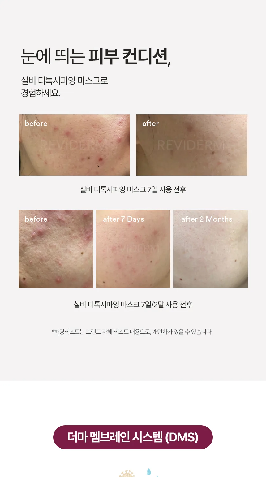 실버 디톡시파잉 마스크 상세페이지5