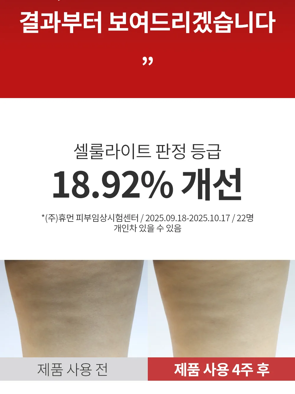 리포엘라 상세 1-5