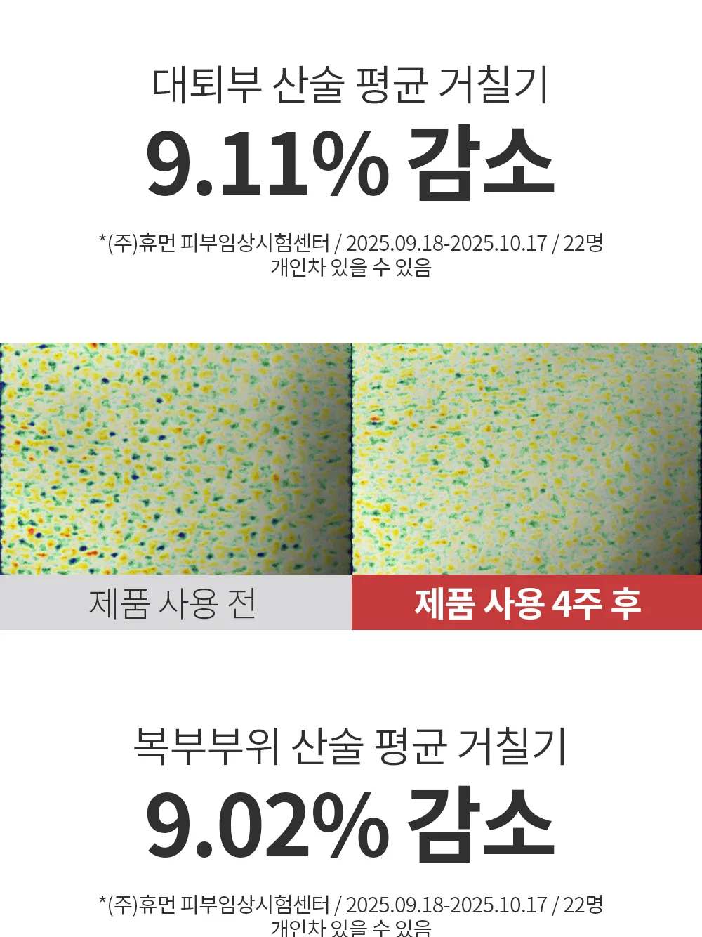 리포엘라 상세 1-6