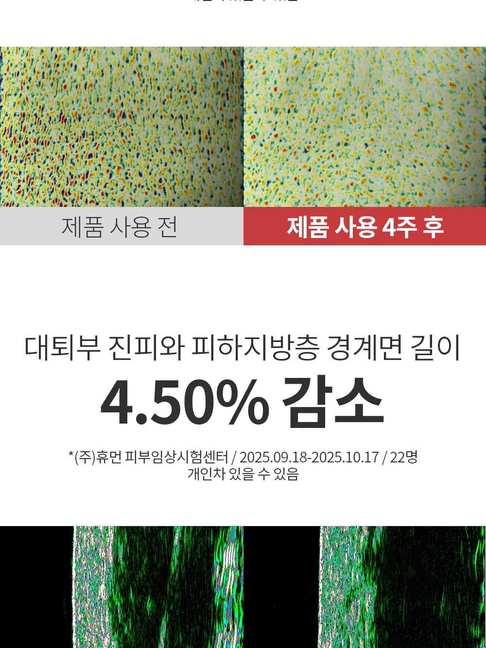 리포엘라 상세 1-7
