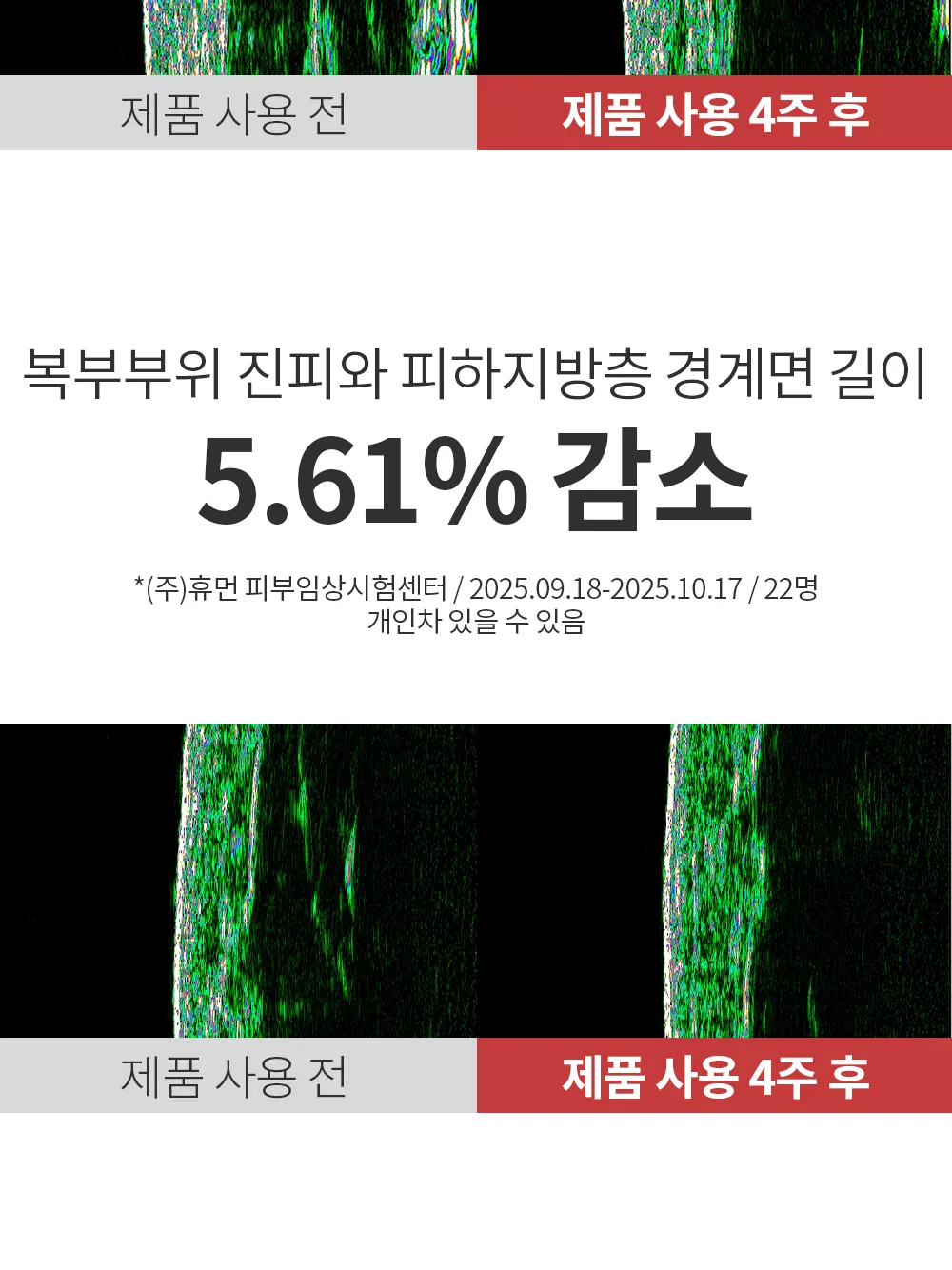 리포엘라 상세 1-8