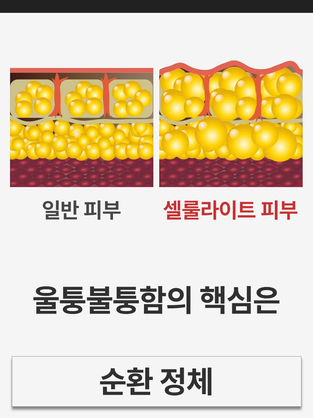 리포엘라 상세 1-19