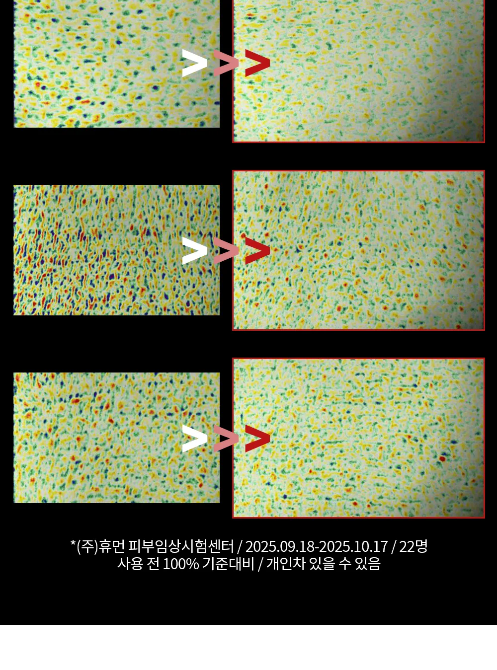 리포엘라 상세 2-9