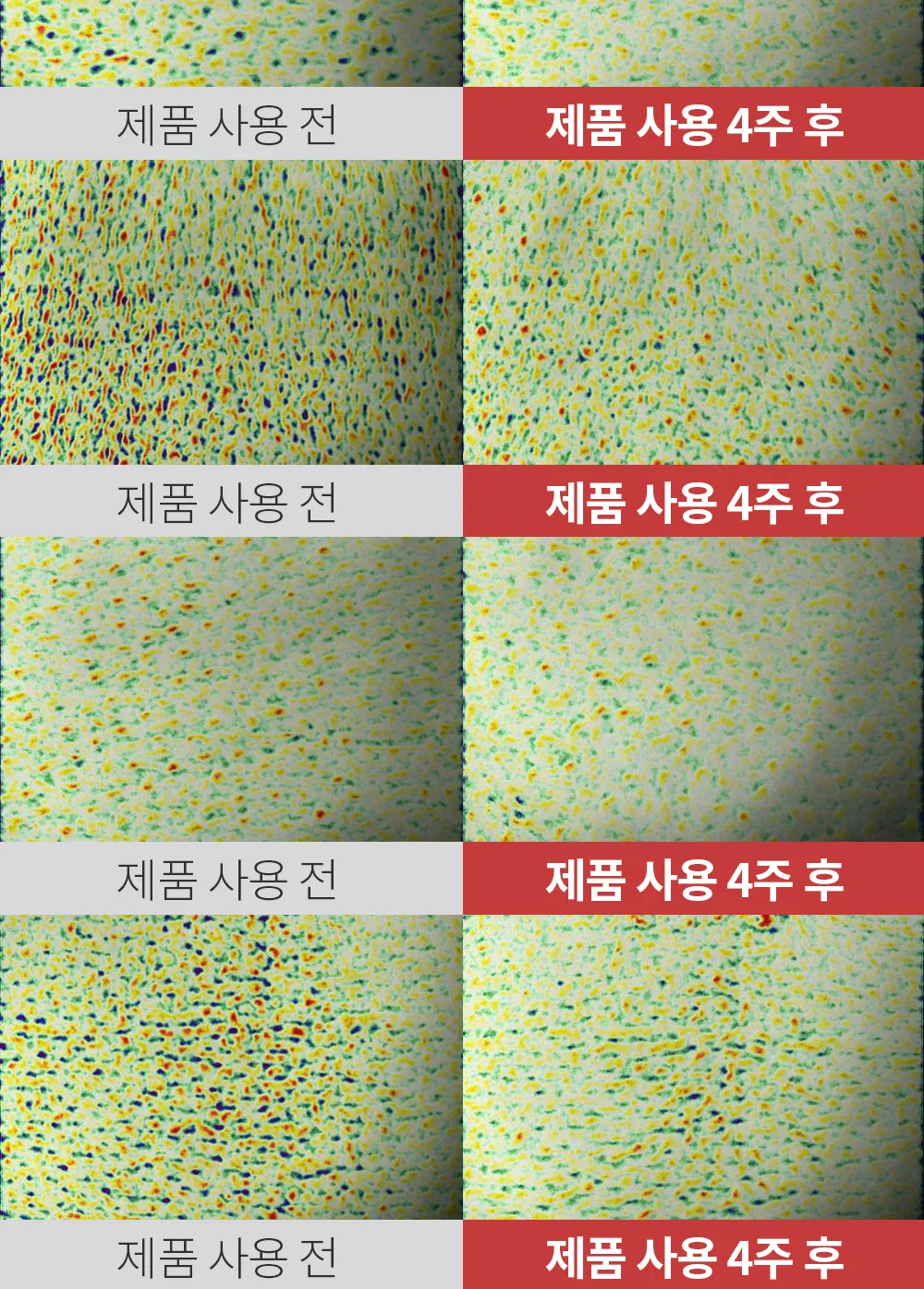 리포엘라 상세 3-6