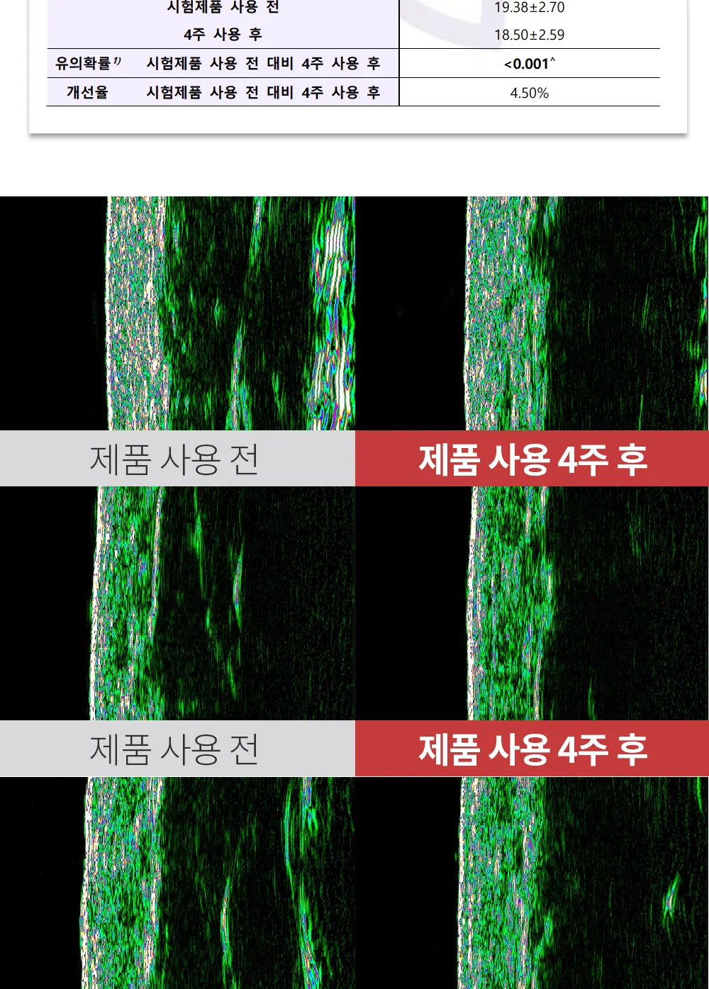 리포엘라 상세 3-8
