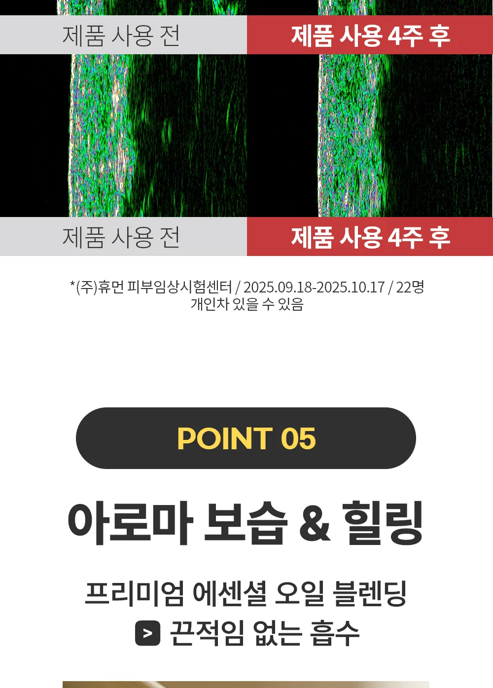 리포엘라 상세 3-9
