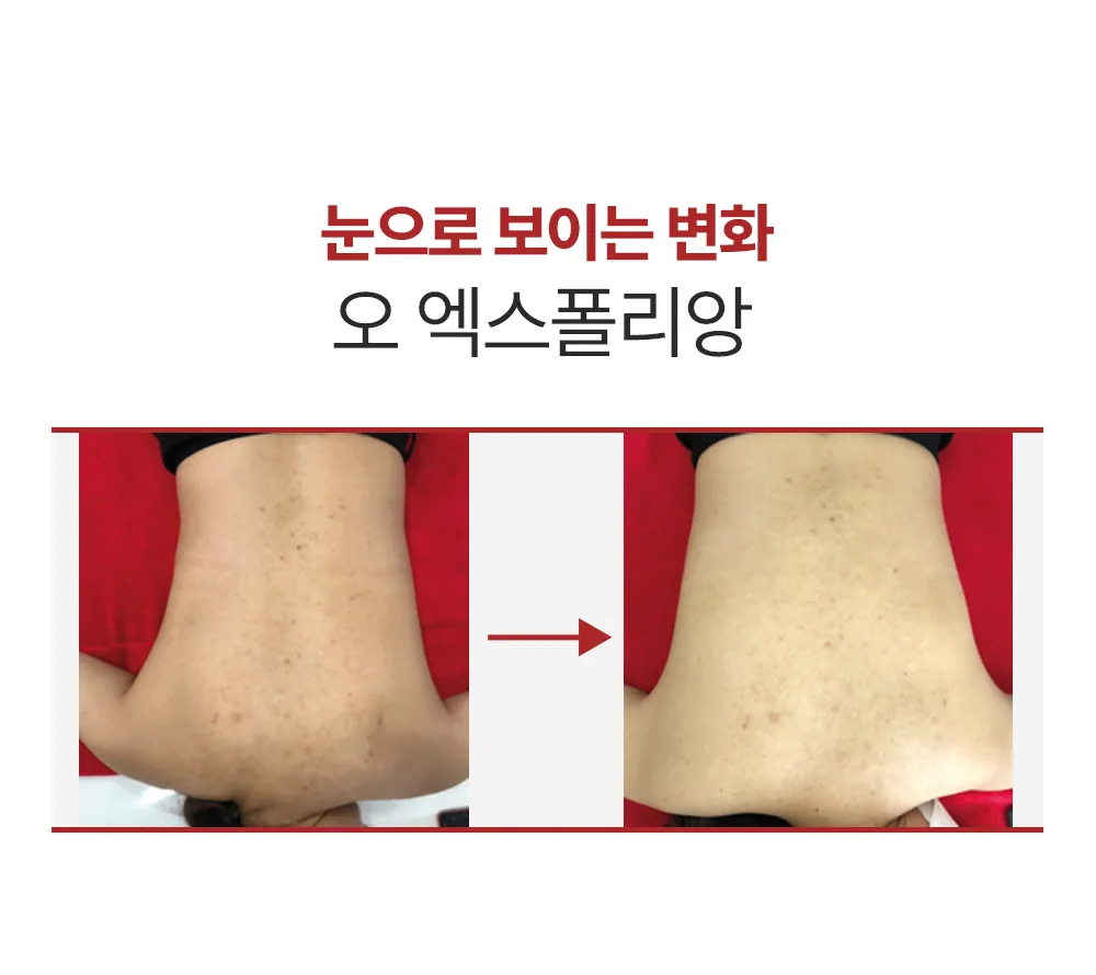 스킨볼릭 오엑스 폴리앙 상세페이지 10