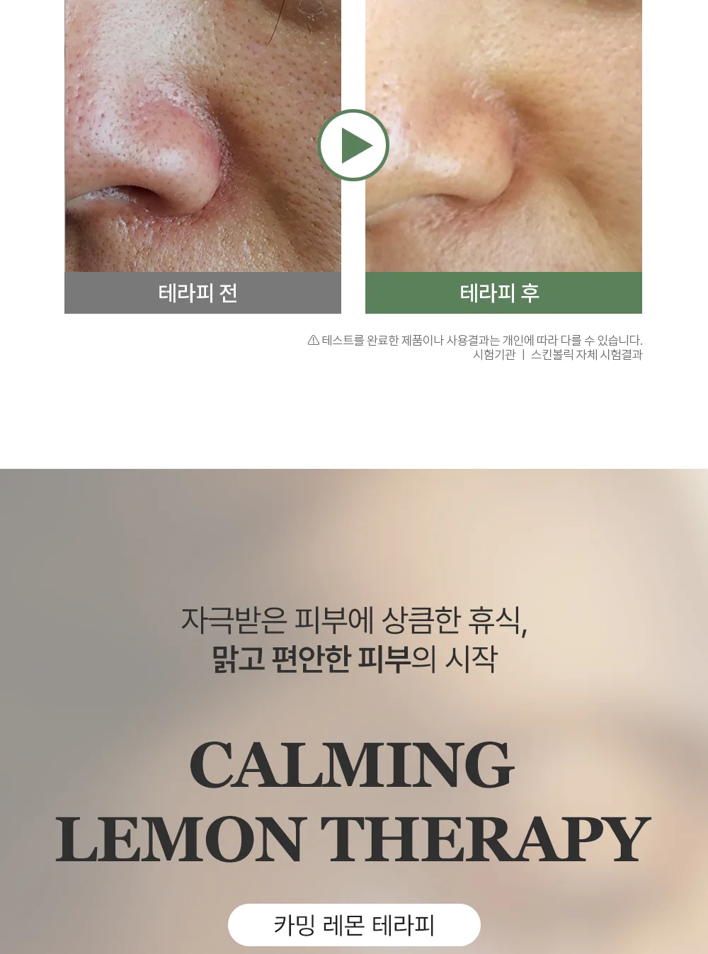 스킨볼릭 카밍 레몬 키트 상세페이지 6