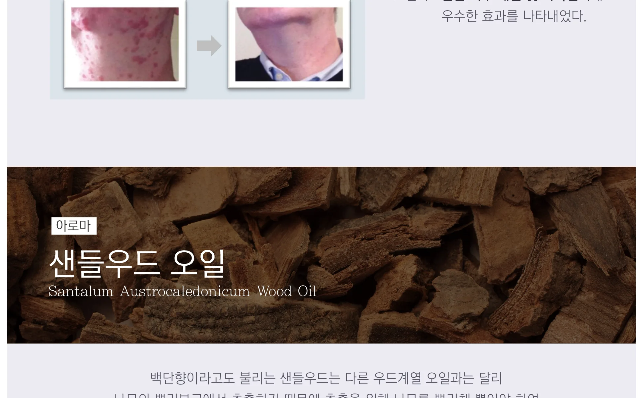 스킨볼릭 트리니티 카밍 앰플 2ml x 30pcs 상세페이지 12