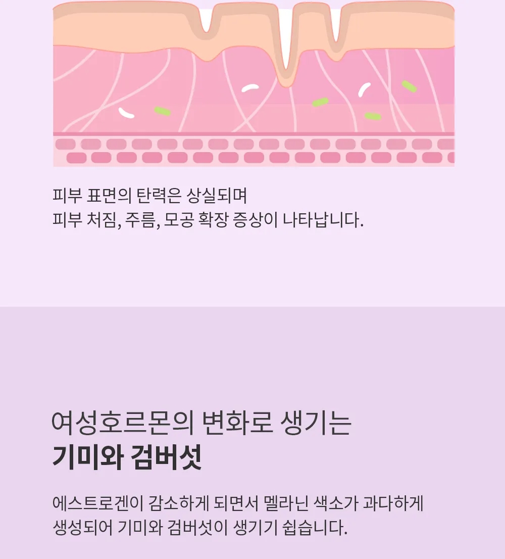 스킨볼릭 에스론 107 키트 상세페이지9